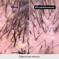 356_17295
